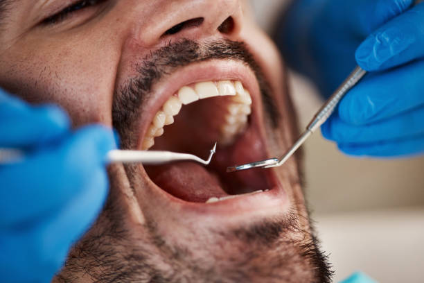 Laser Dentistry in Lafayette, IN